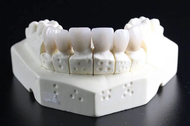 Dental crown model